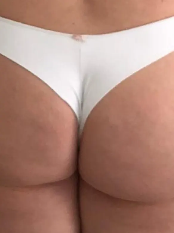 Depois do uso