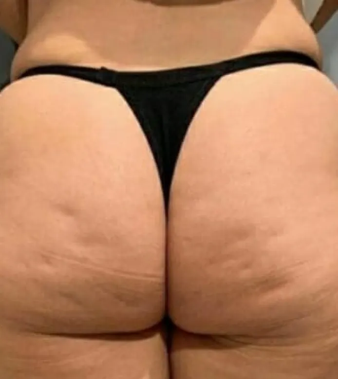 Antes