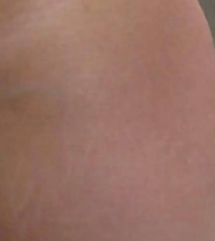 Depois